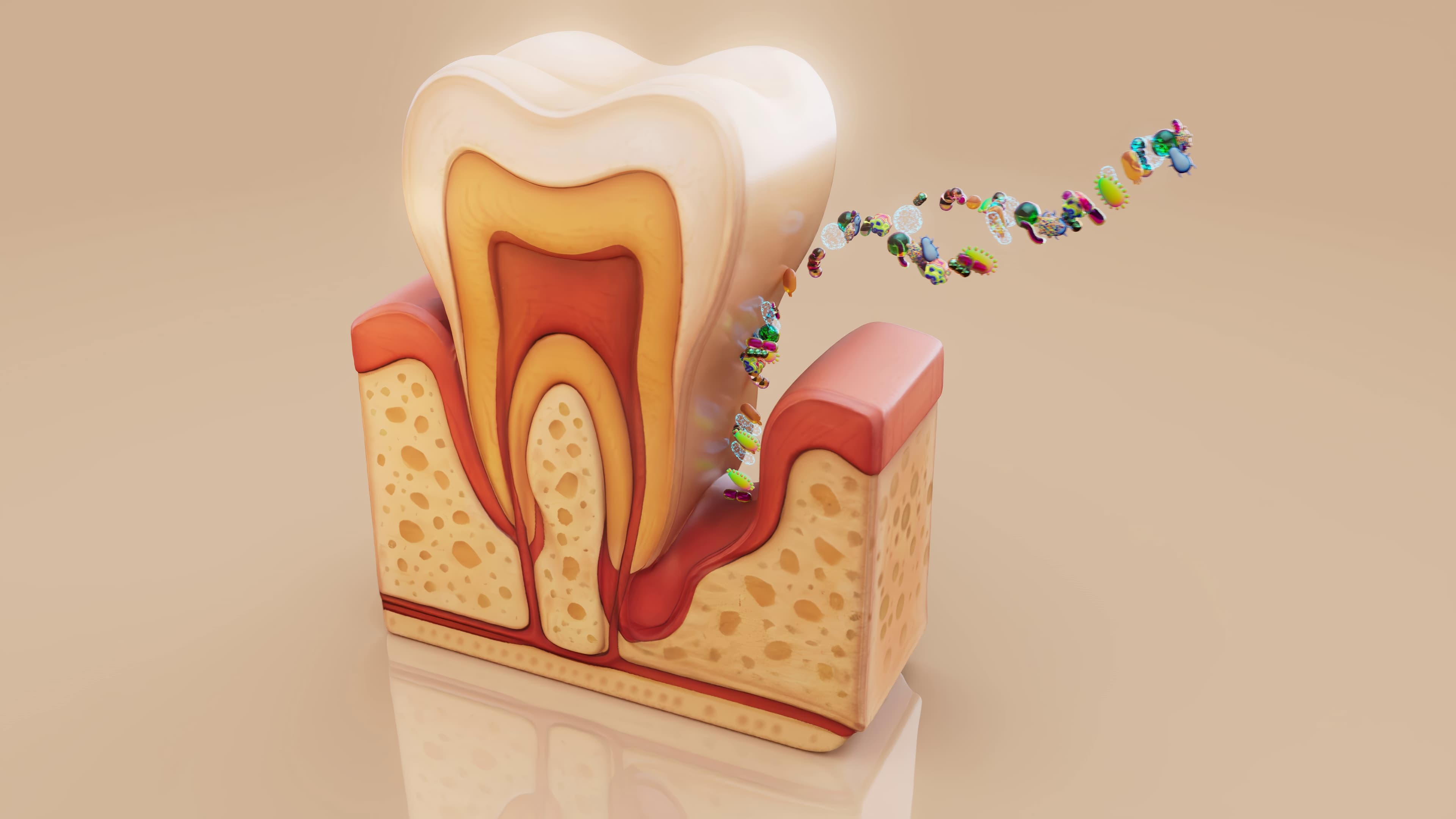 Boala parodontală — retracție gingivală și afectare osoasă